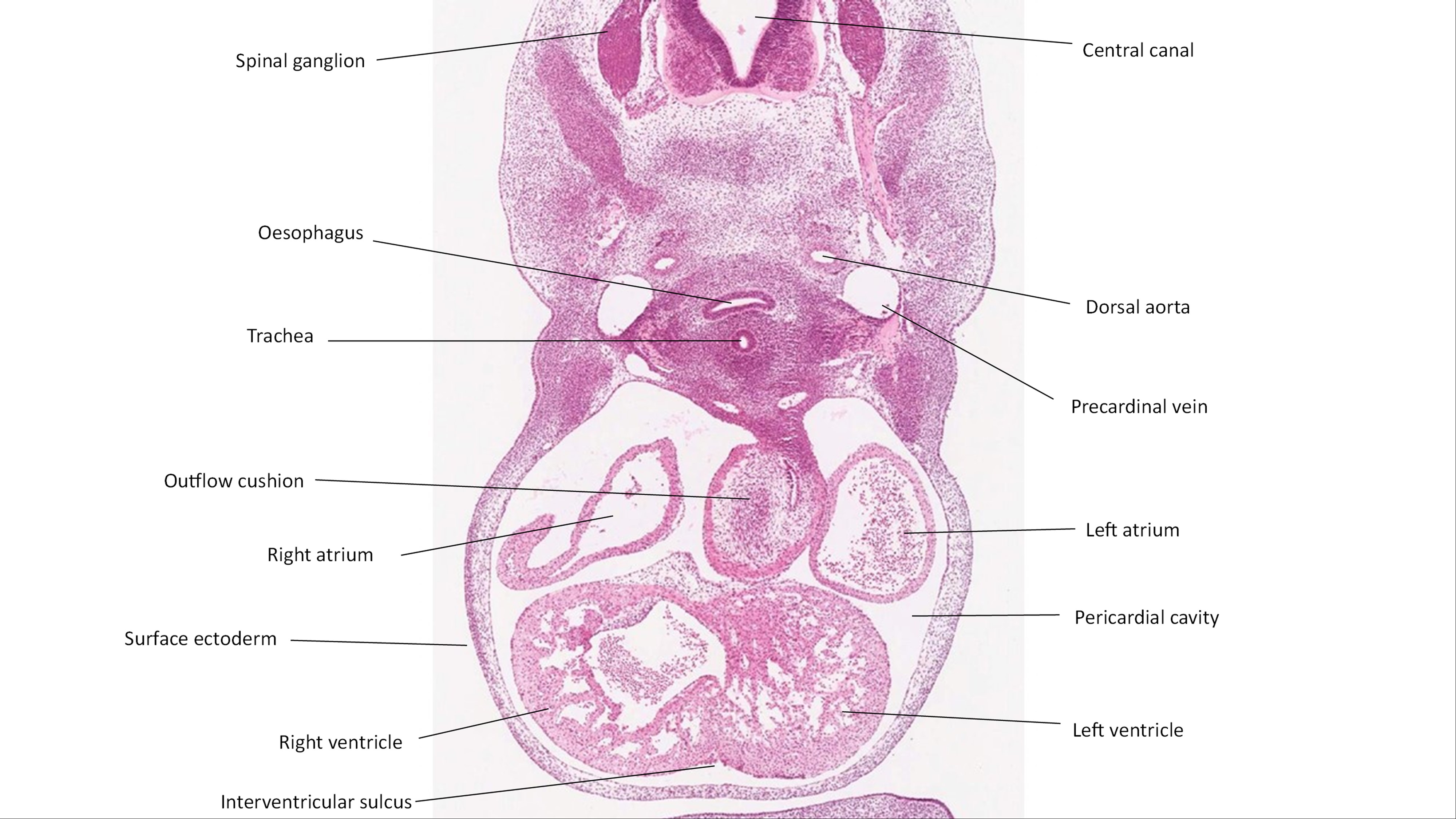 A histology section of a human embryo