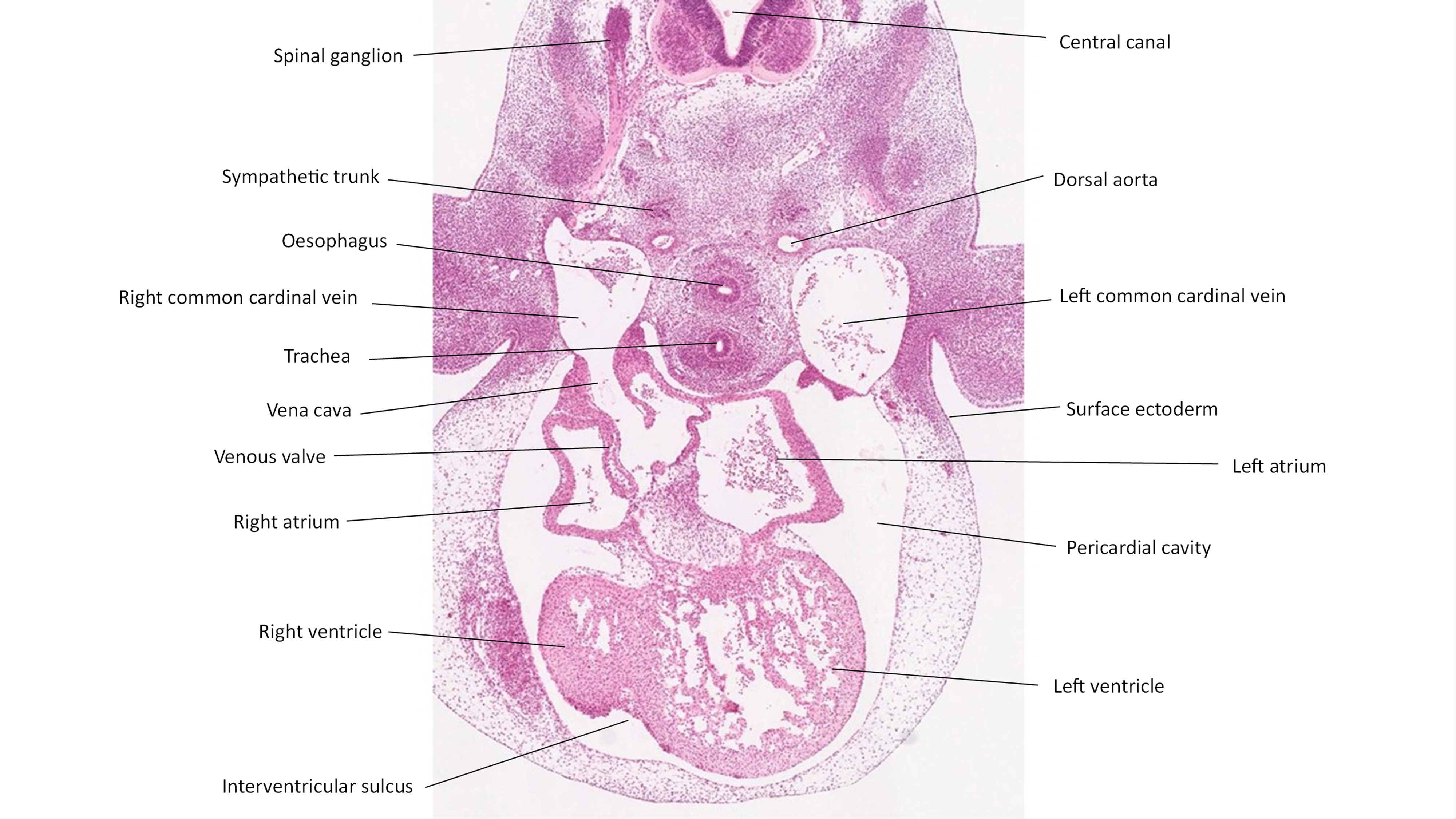 A histology section of a human embryo