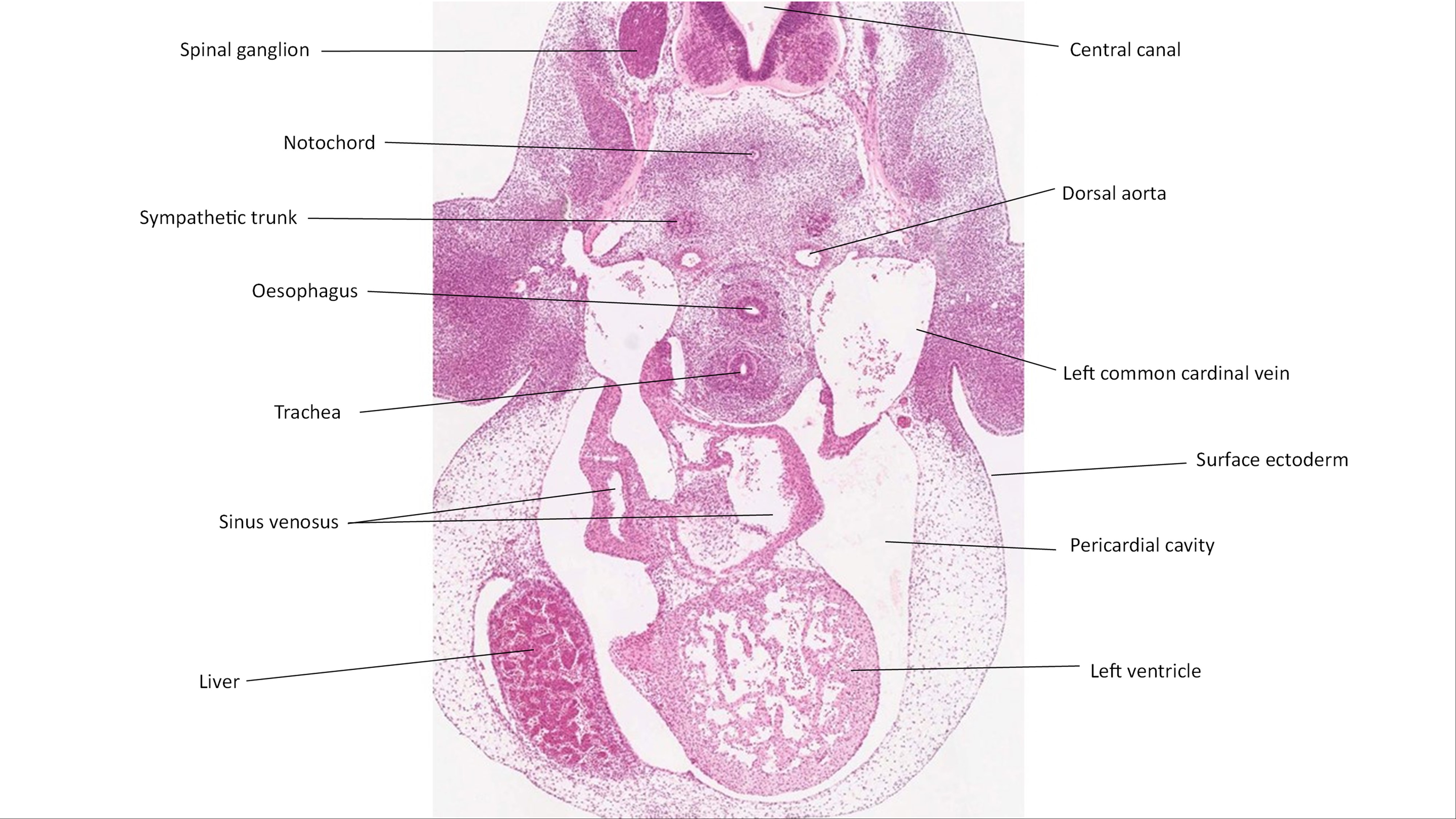 A histology section of a human embryo