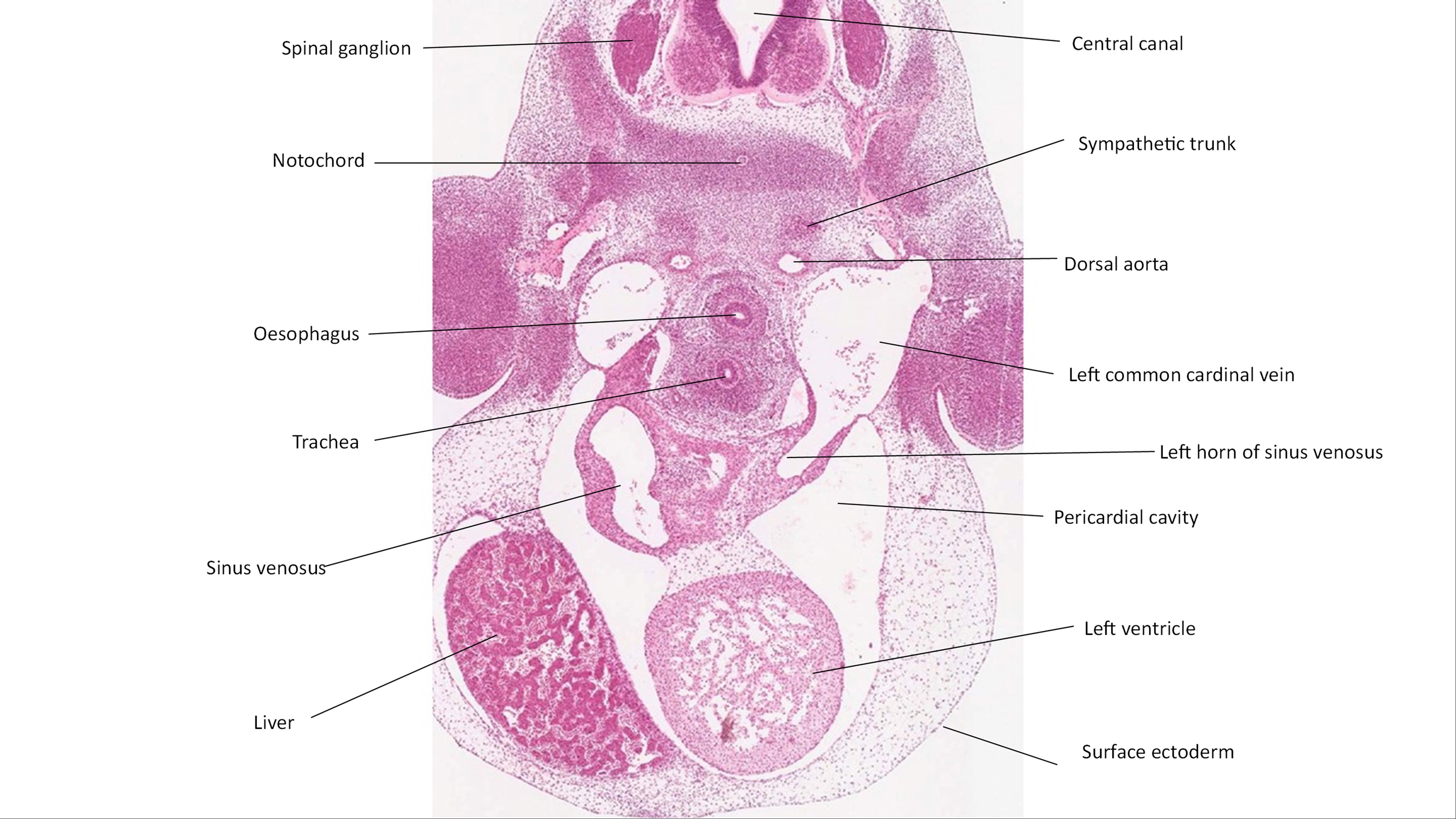 A histology section of a human embryo