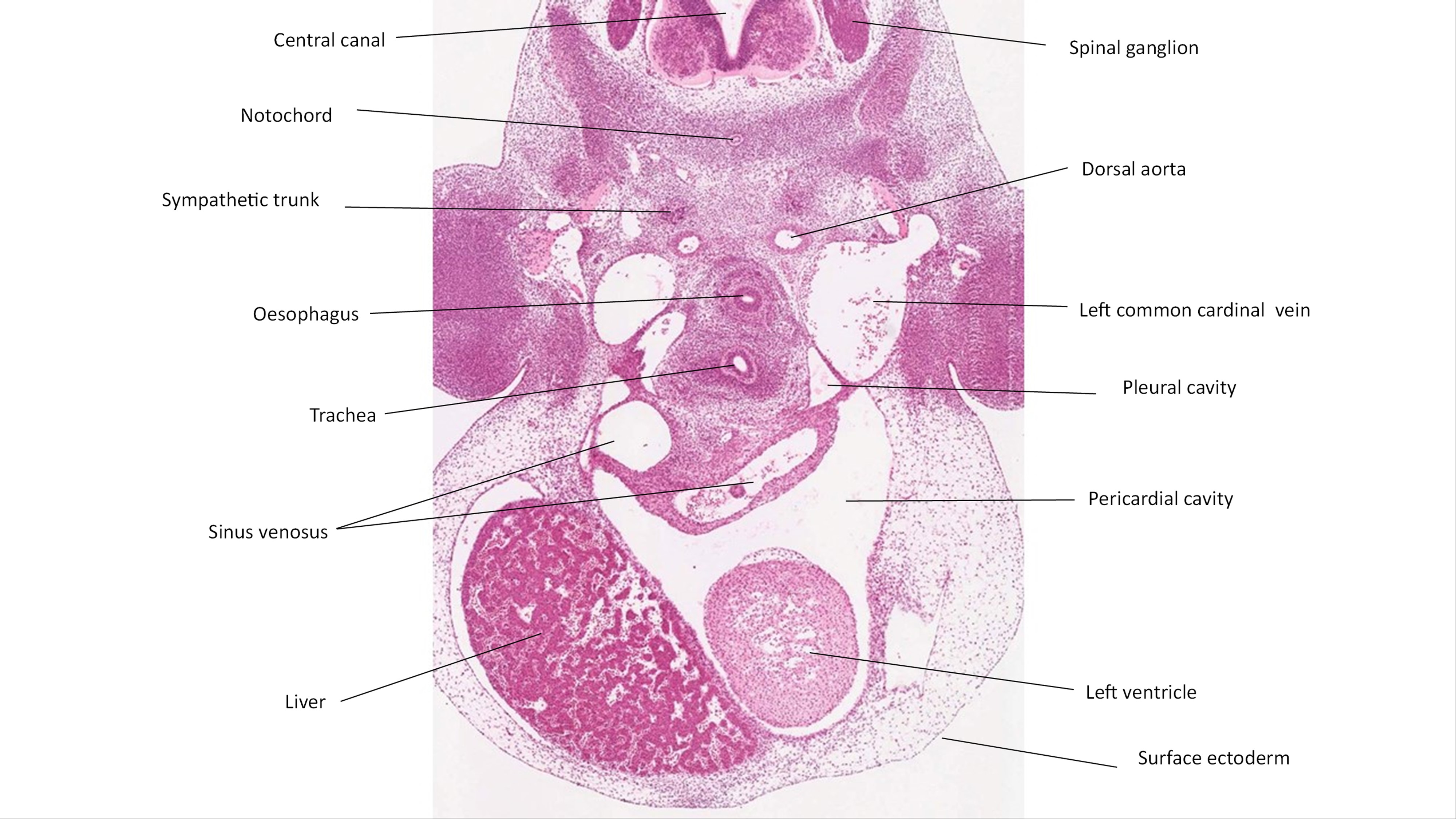 A histology section of a human embryo