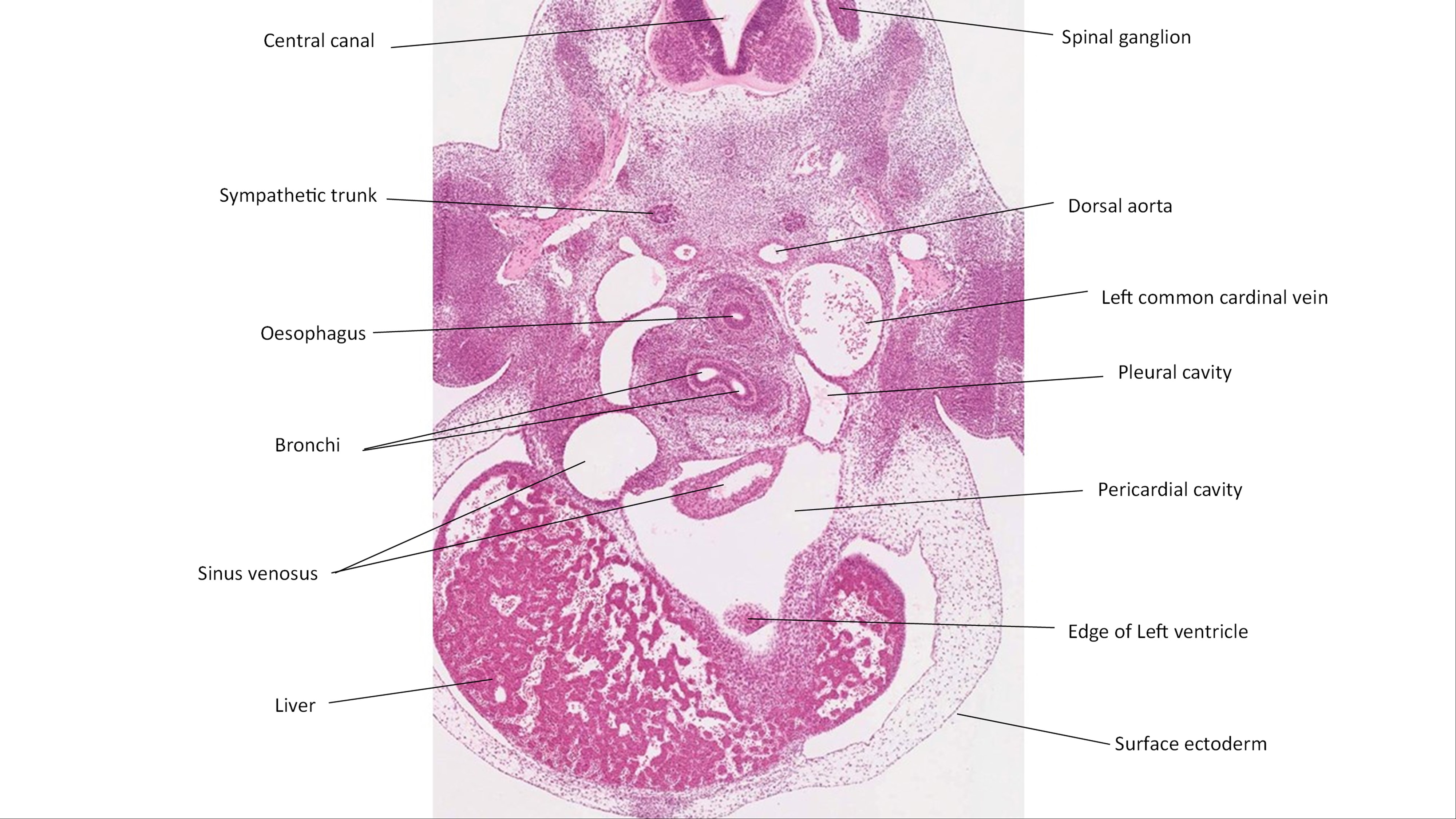 A histology section of a human embryo