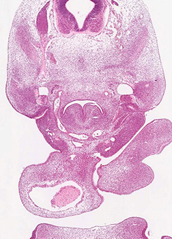 A histology section of a human embryo