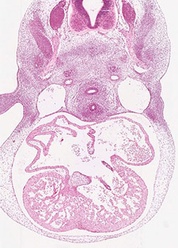 A histology section of a human embryo
