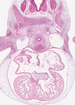 A histology section of a human embryo