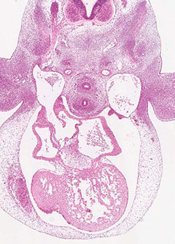 A histology section of a human embryo