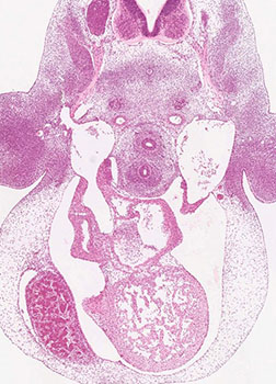 A histology section of a human embryo