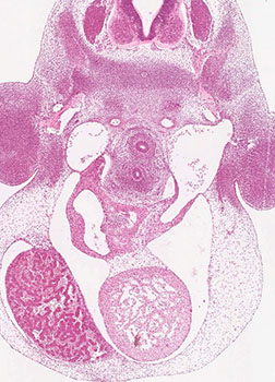 A histology section of a human embryo
