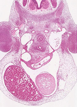 A histology section of a human embryo