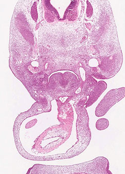 A histology section of a human embryo