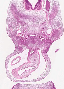 A histology section of a human embryo