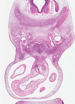 A histology section of a human embryo