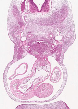 A histology section of a human embryo