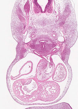 A histology section of a human embryo