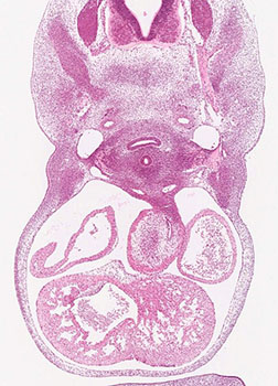 A histology section of a human embryo