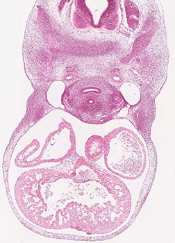 A histology section of a human embryo