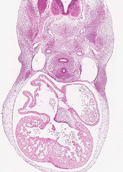 A histology section of a human embryo