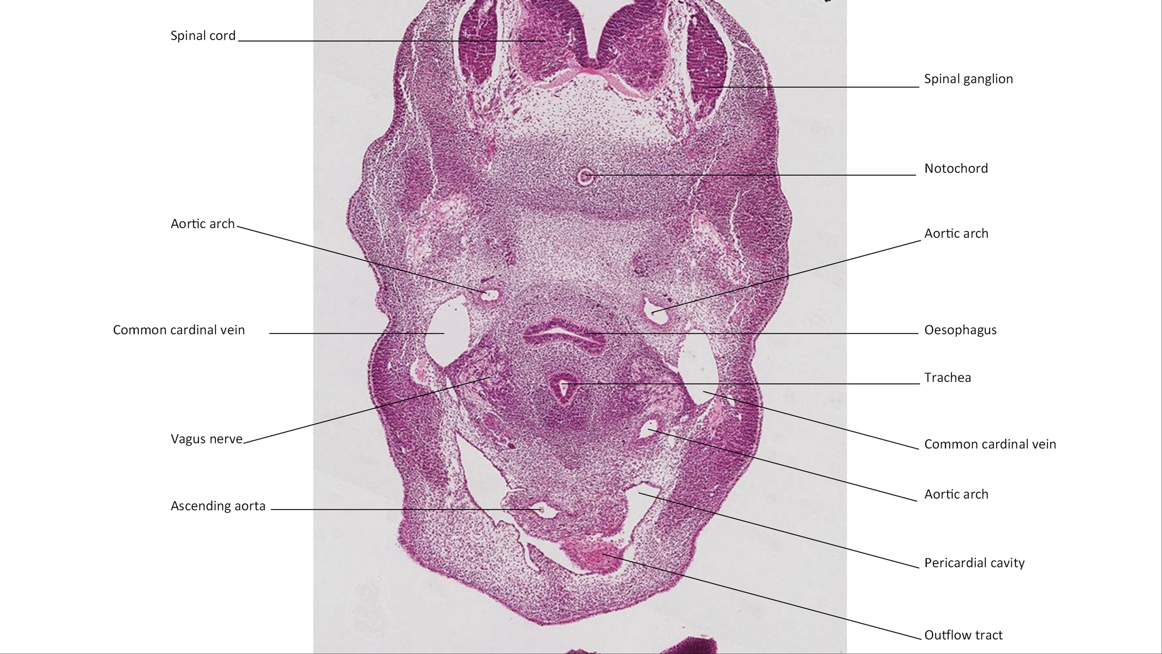 A histology section of a human embryo