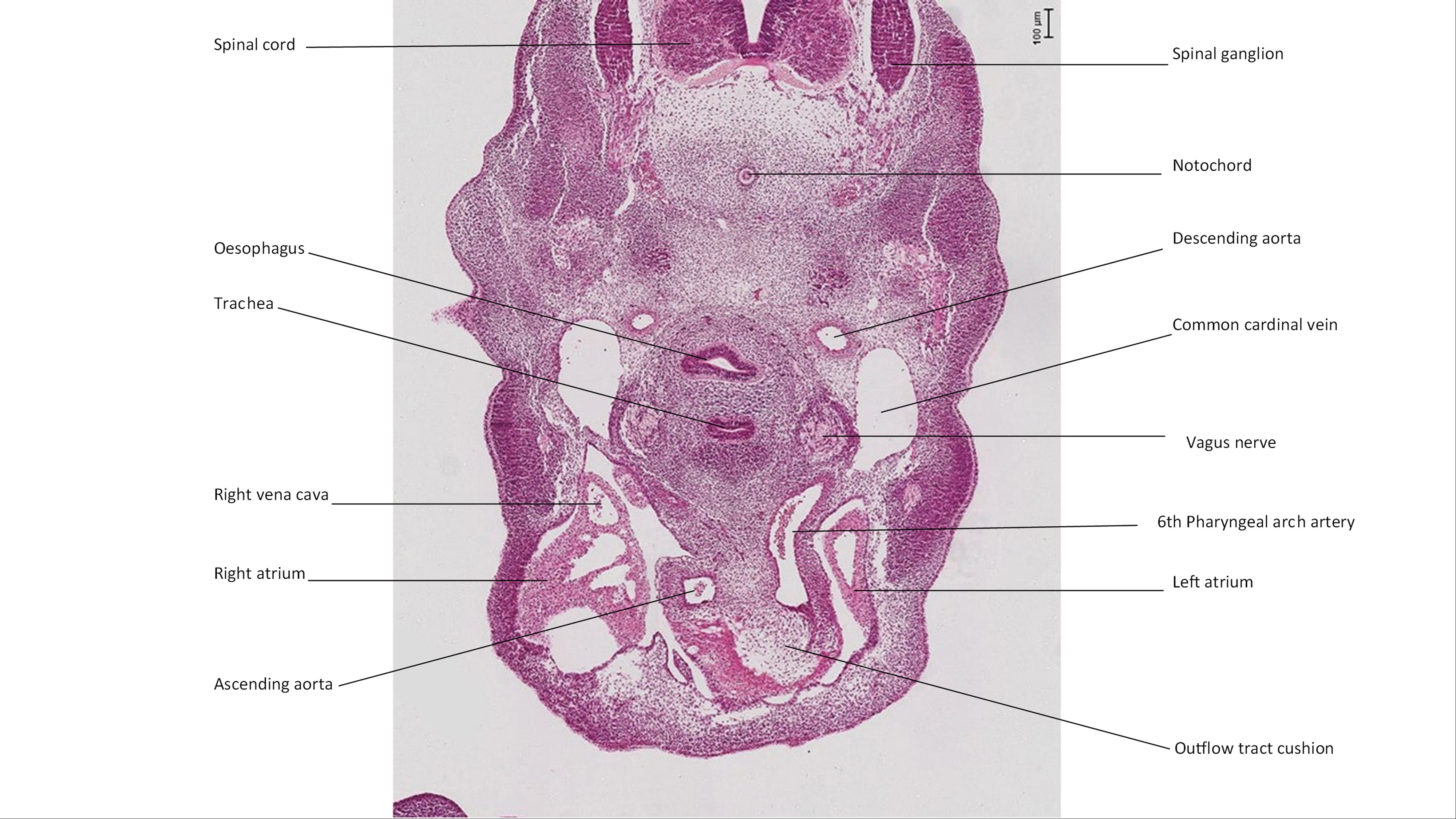 A histology section of a human embryo