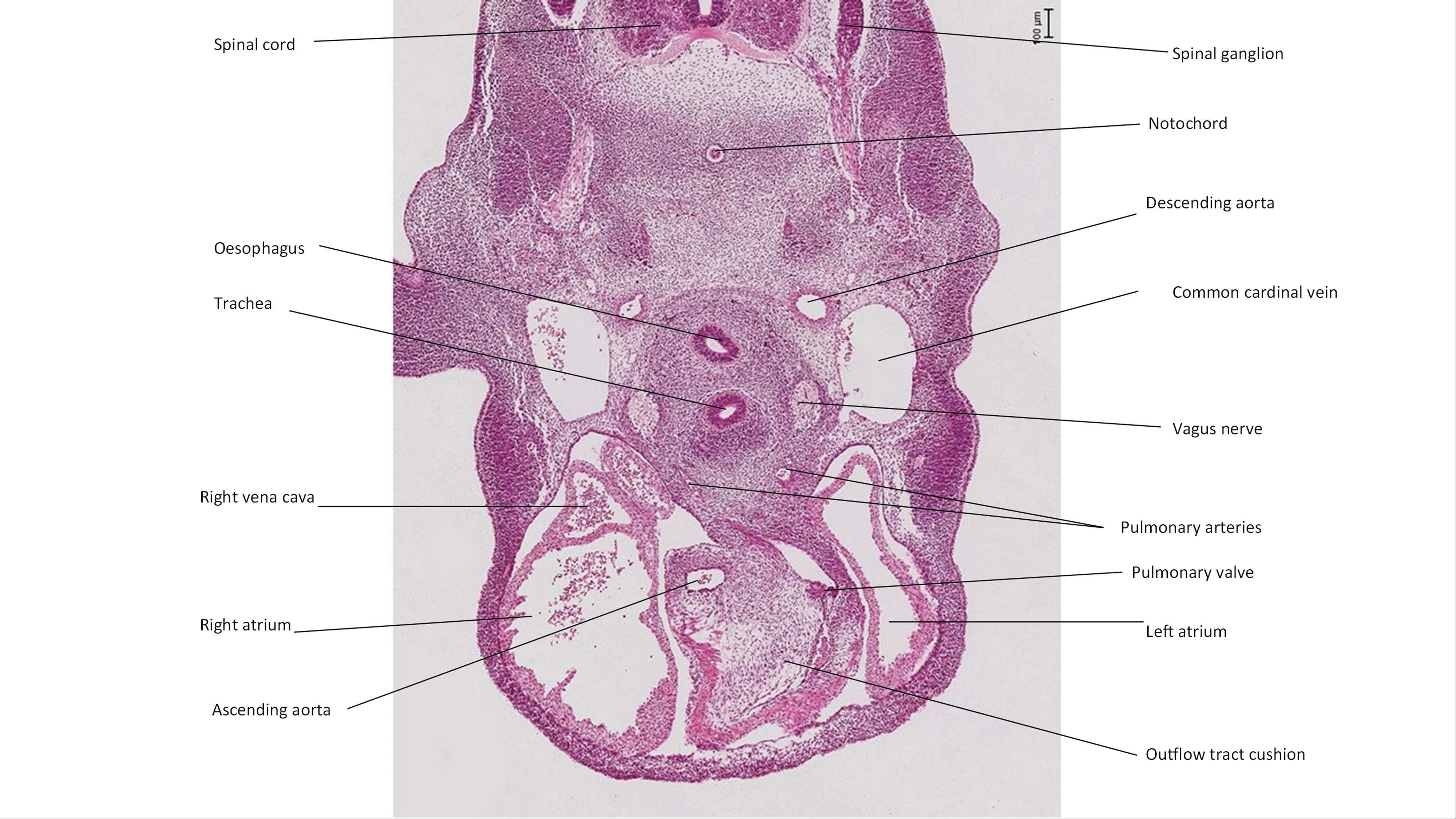 A histology section of a human embryo