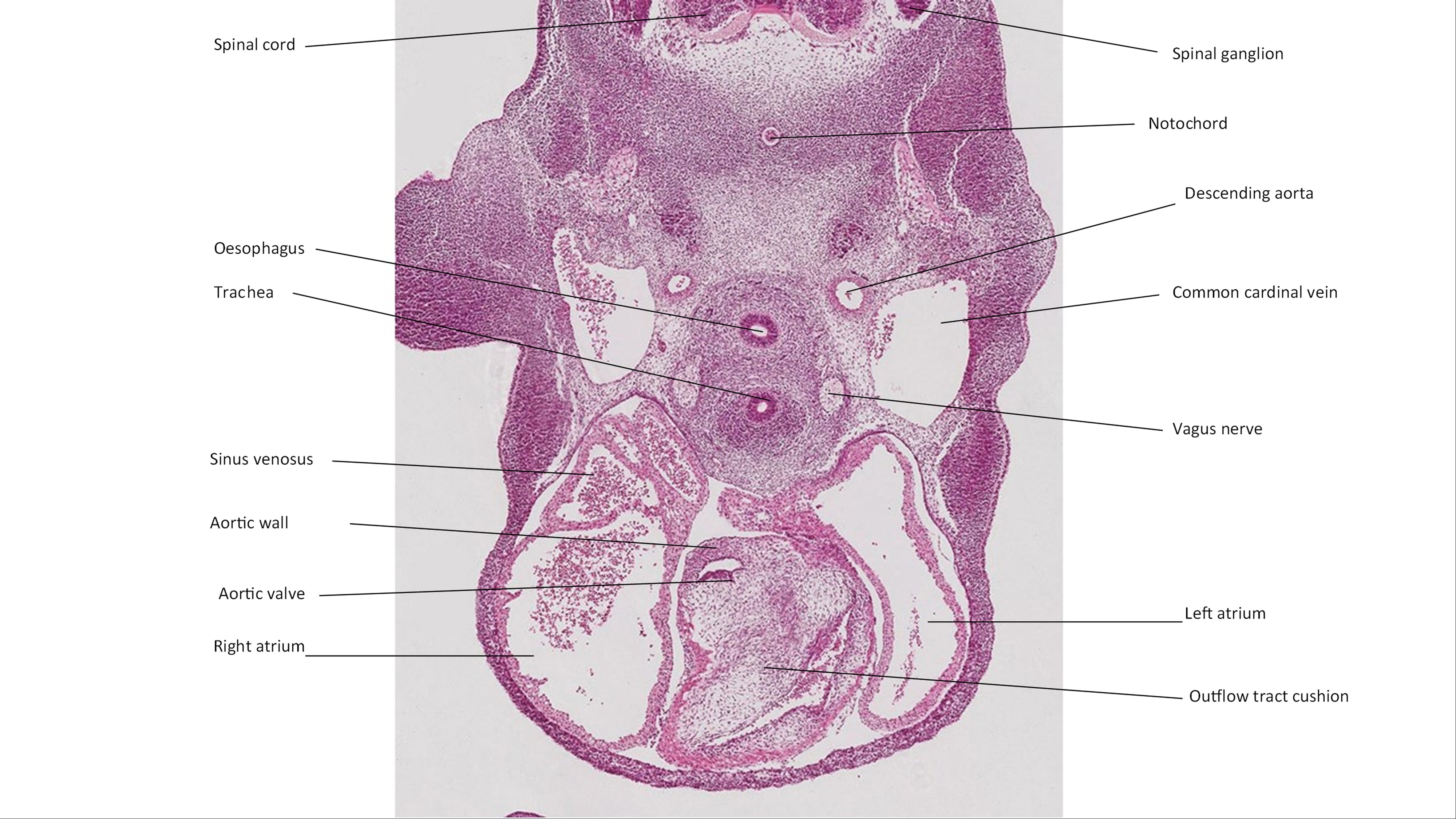A histology section of a human embryo