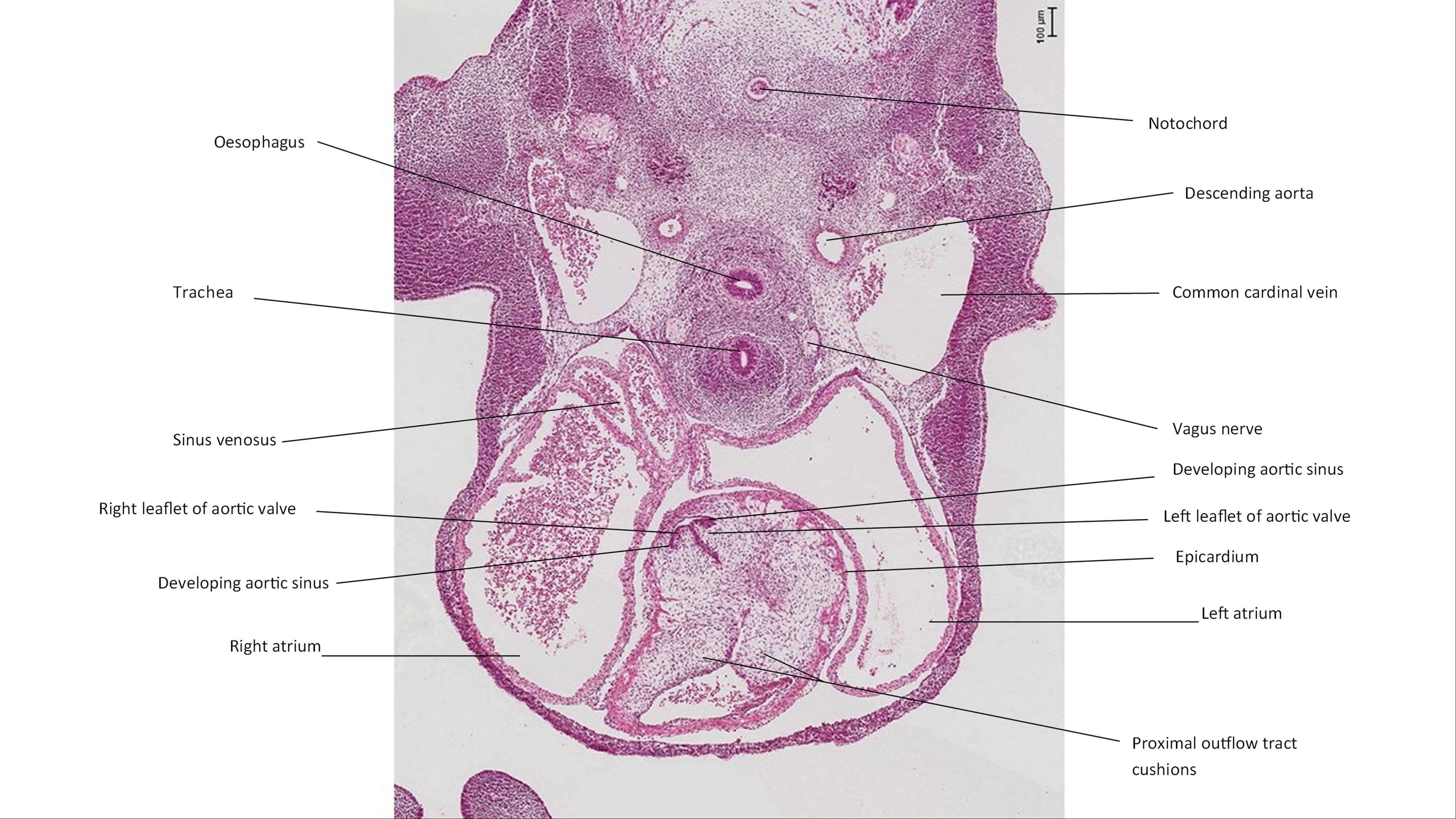 A histology section of a human embryo
