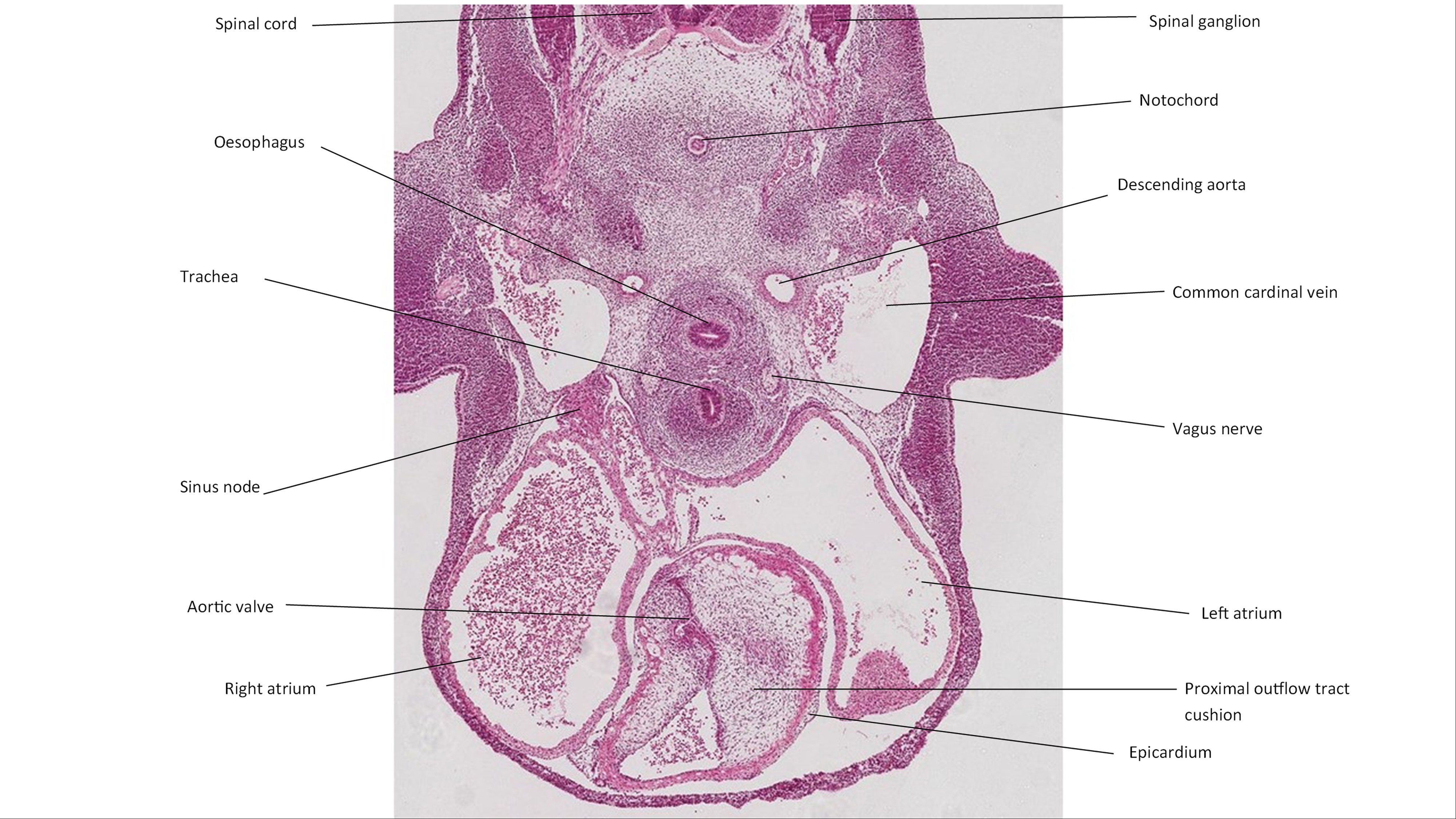 A histology section of a human embryo