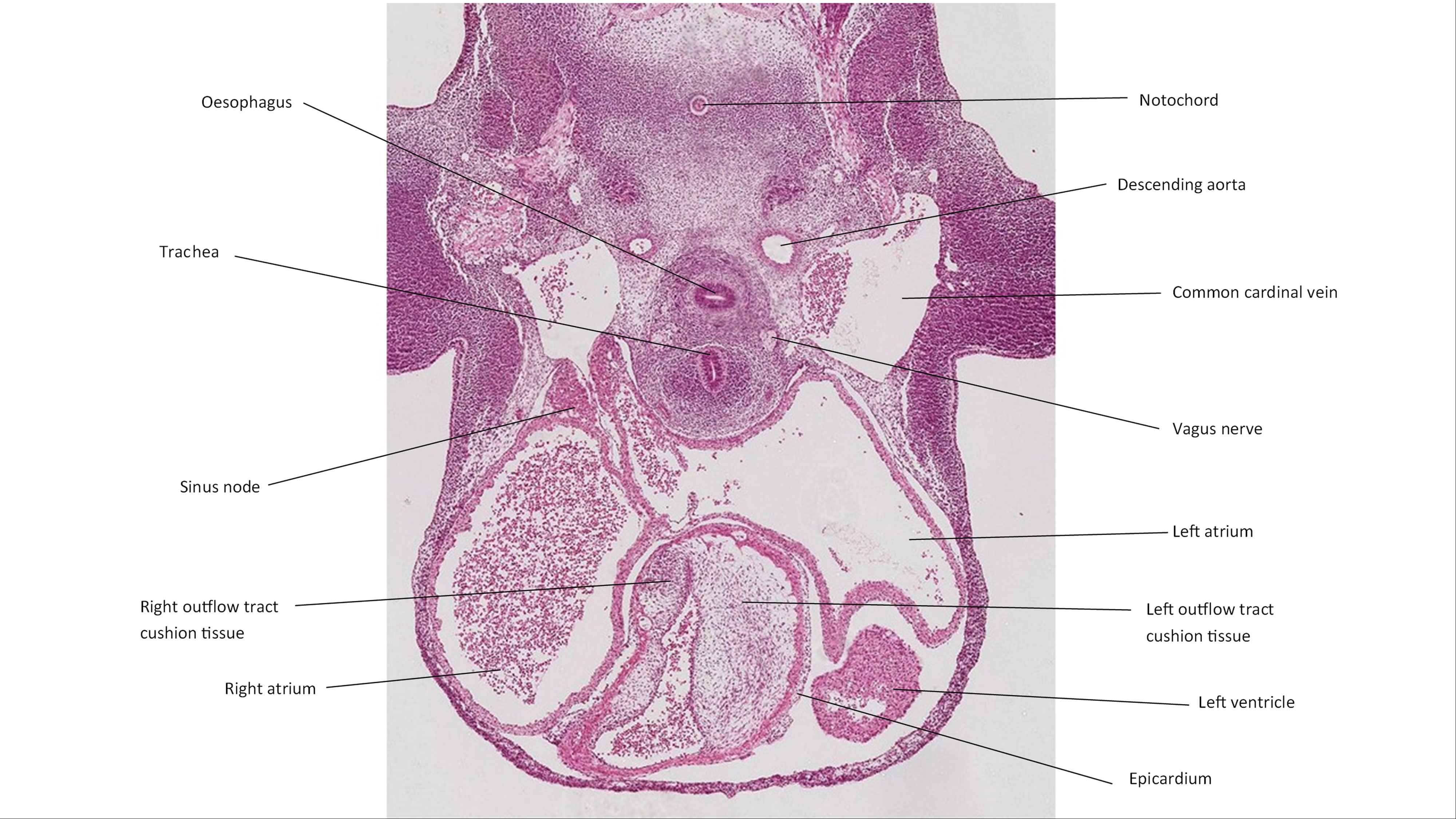 A histology section of a human embryo