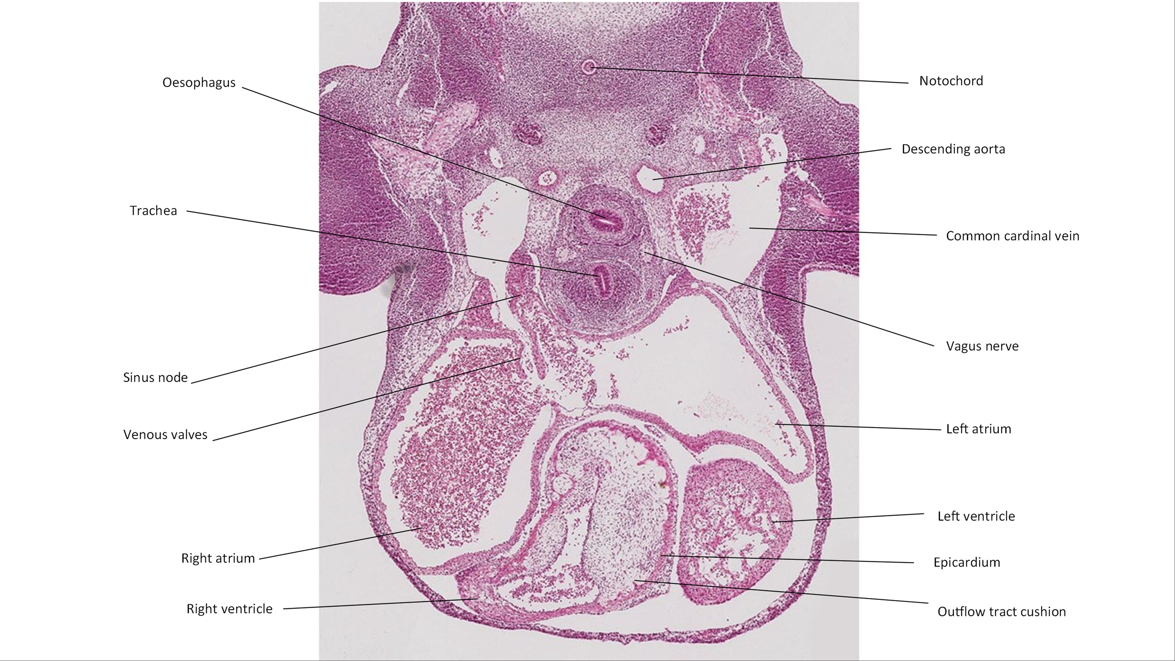 A histology section of a human embryo