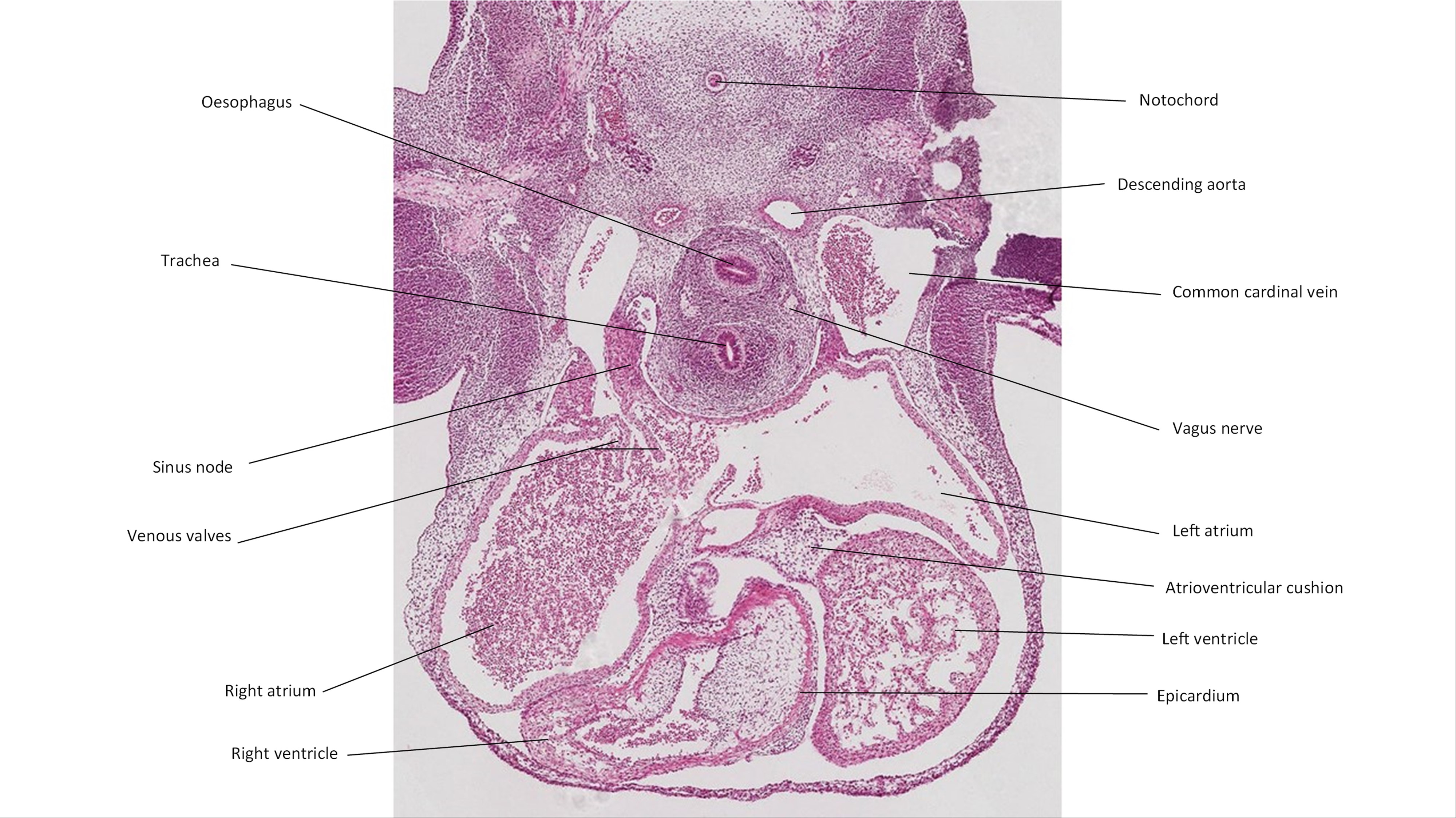 A histology section of a human embryo