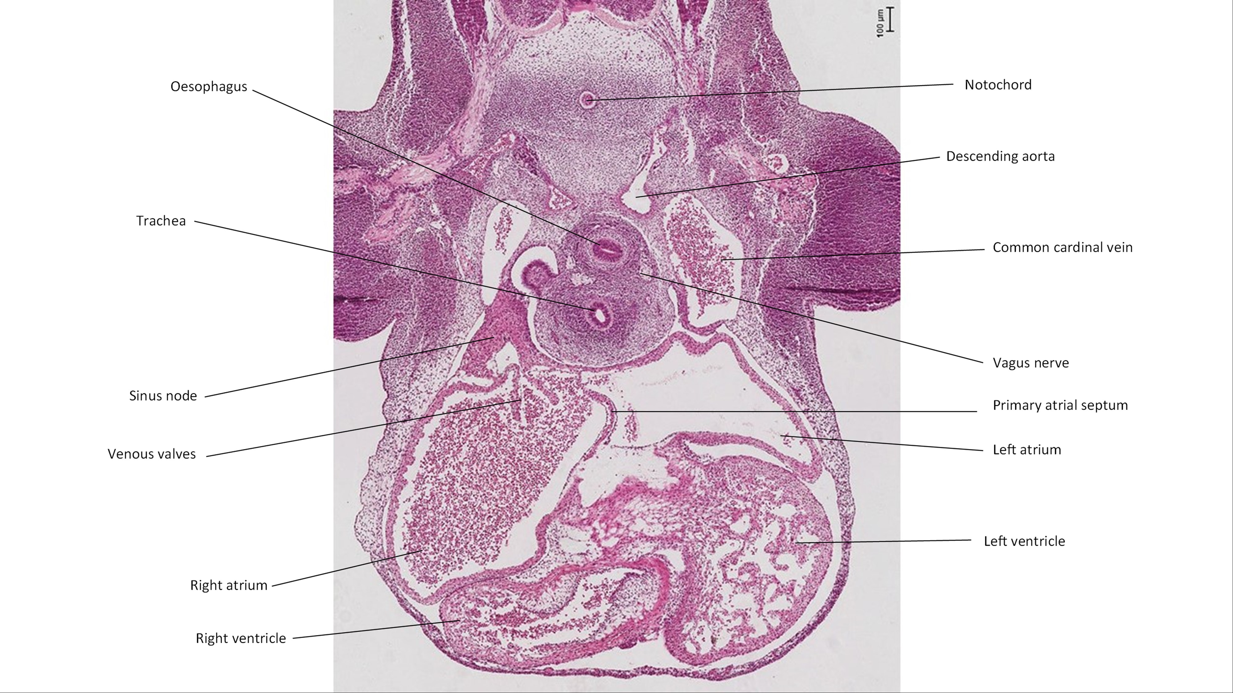 A histology section of a human embryo