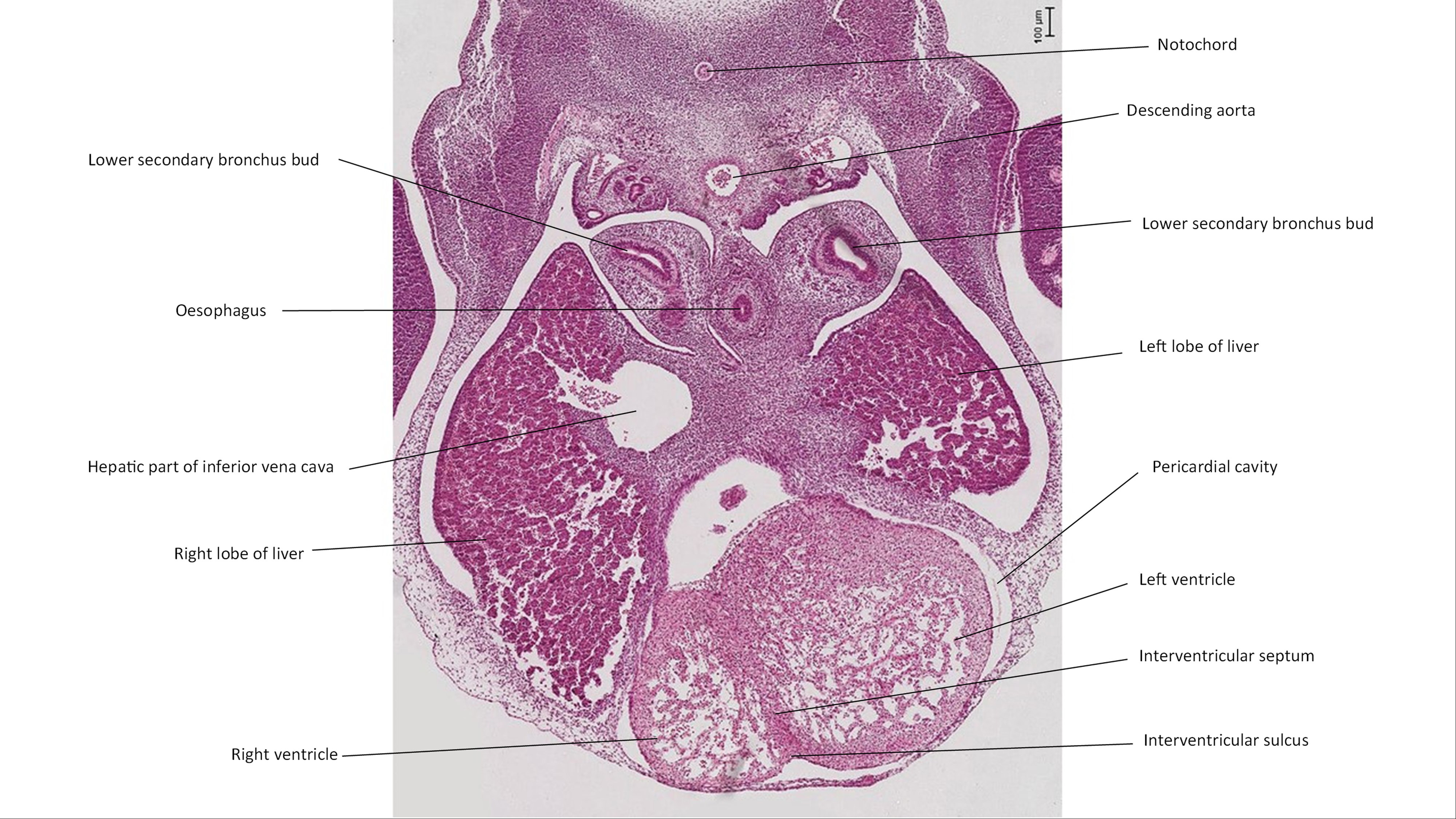 A histology section of a human embryo