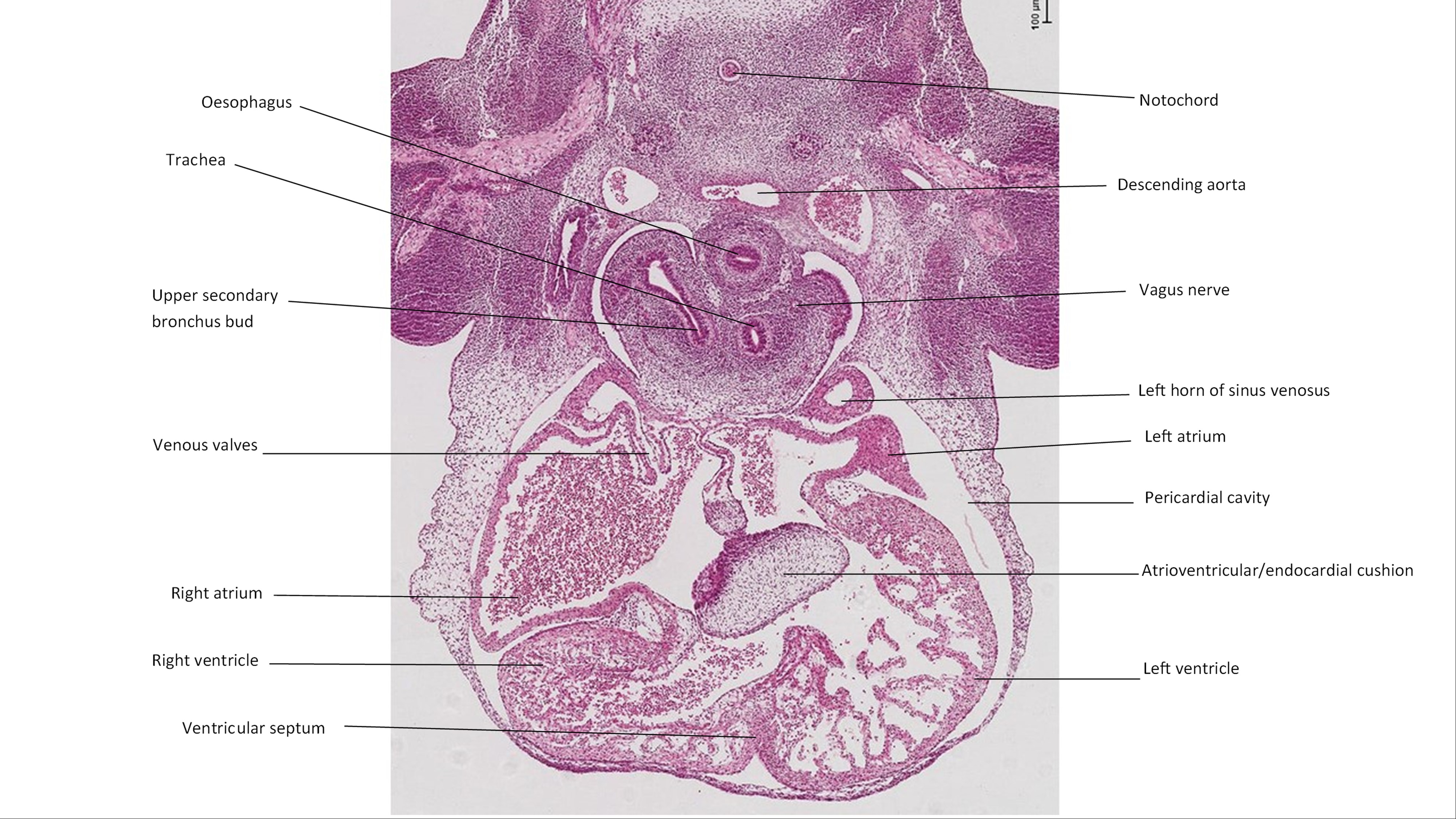 A histology section of a human embryo