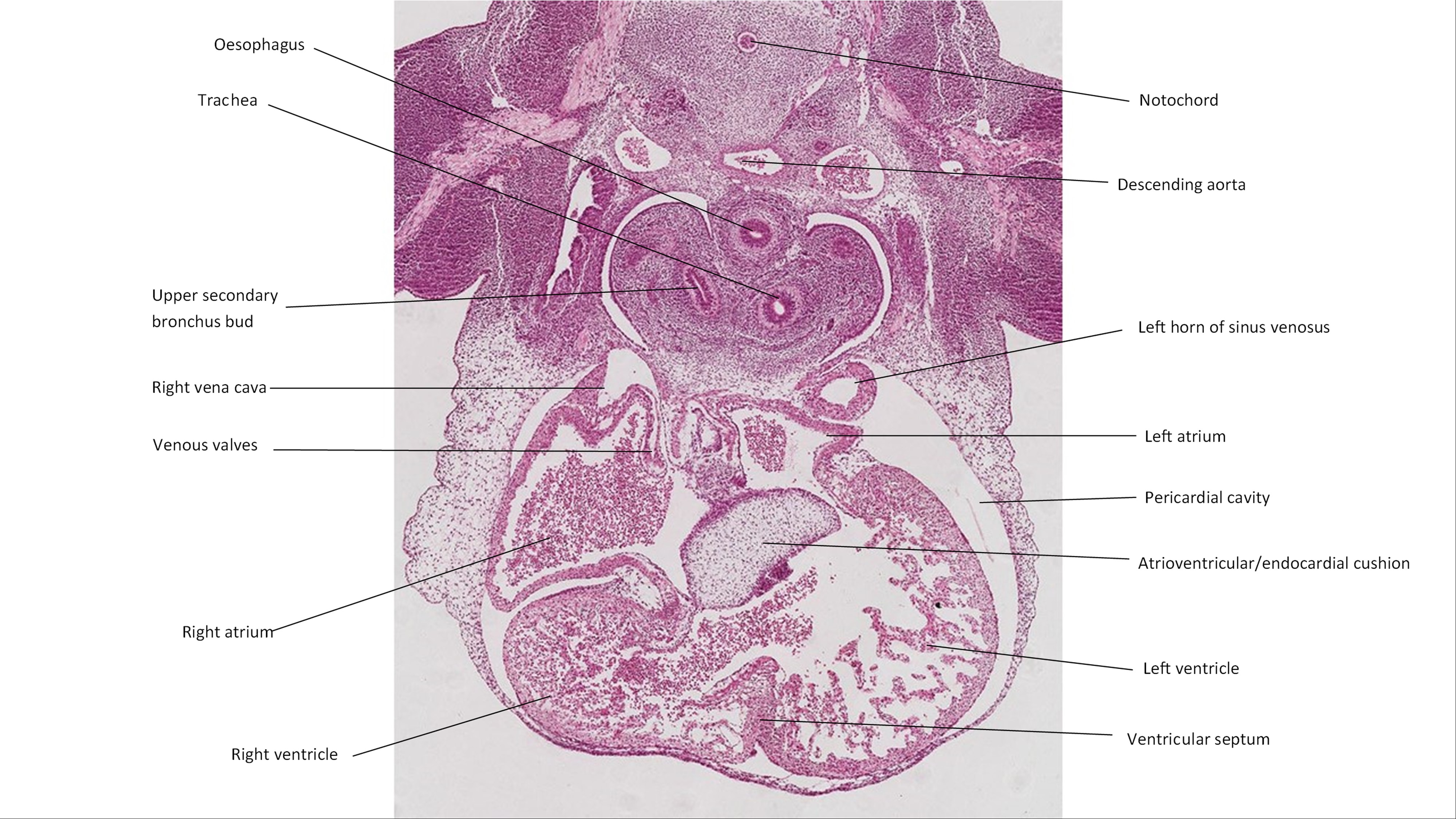 A histology section of a human embryo