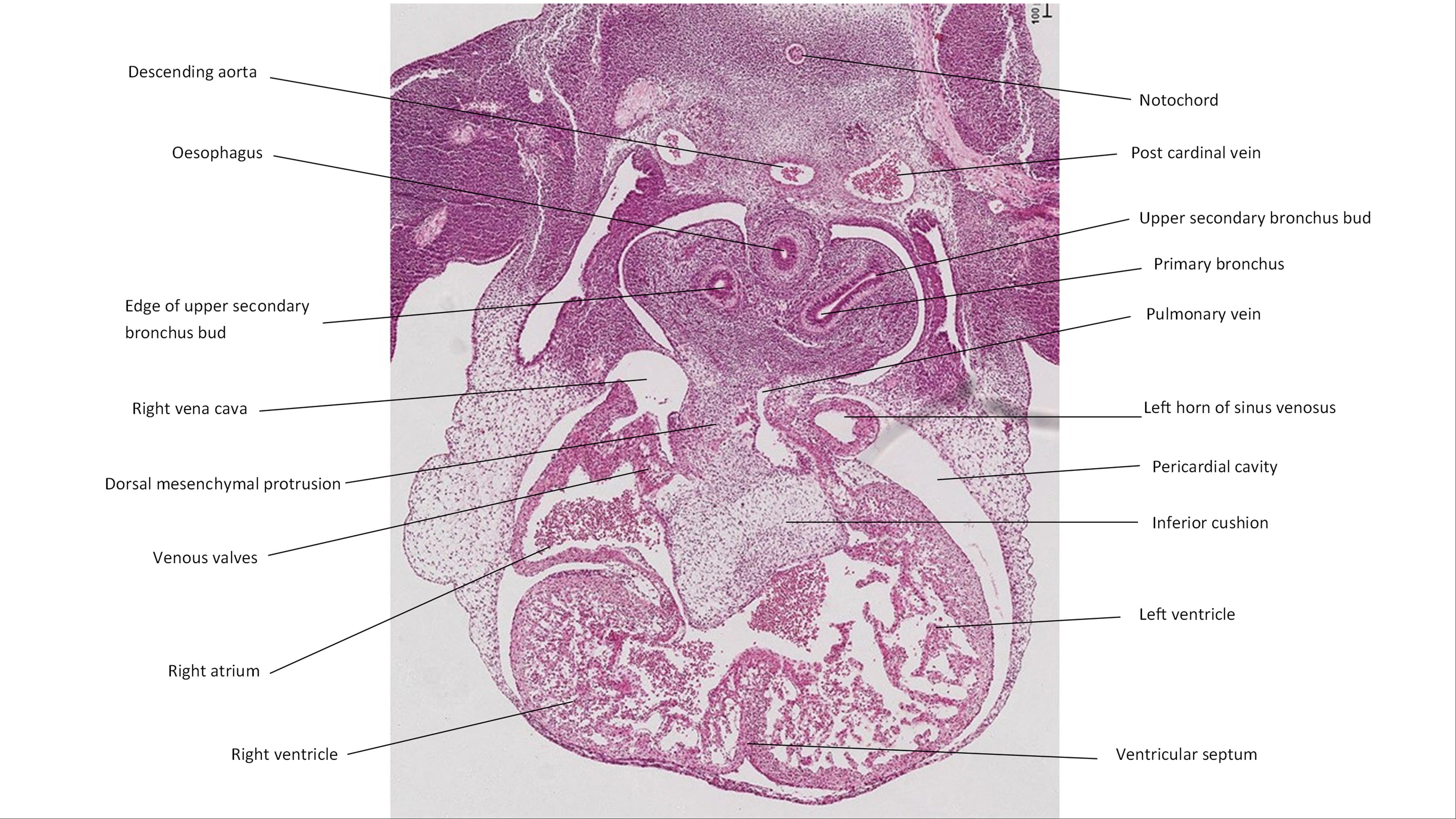 A histology section of a human embryo