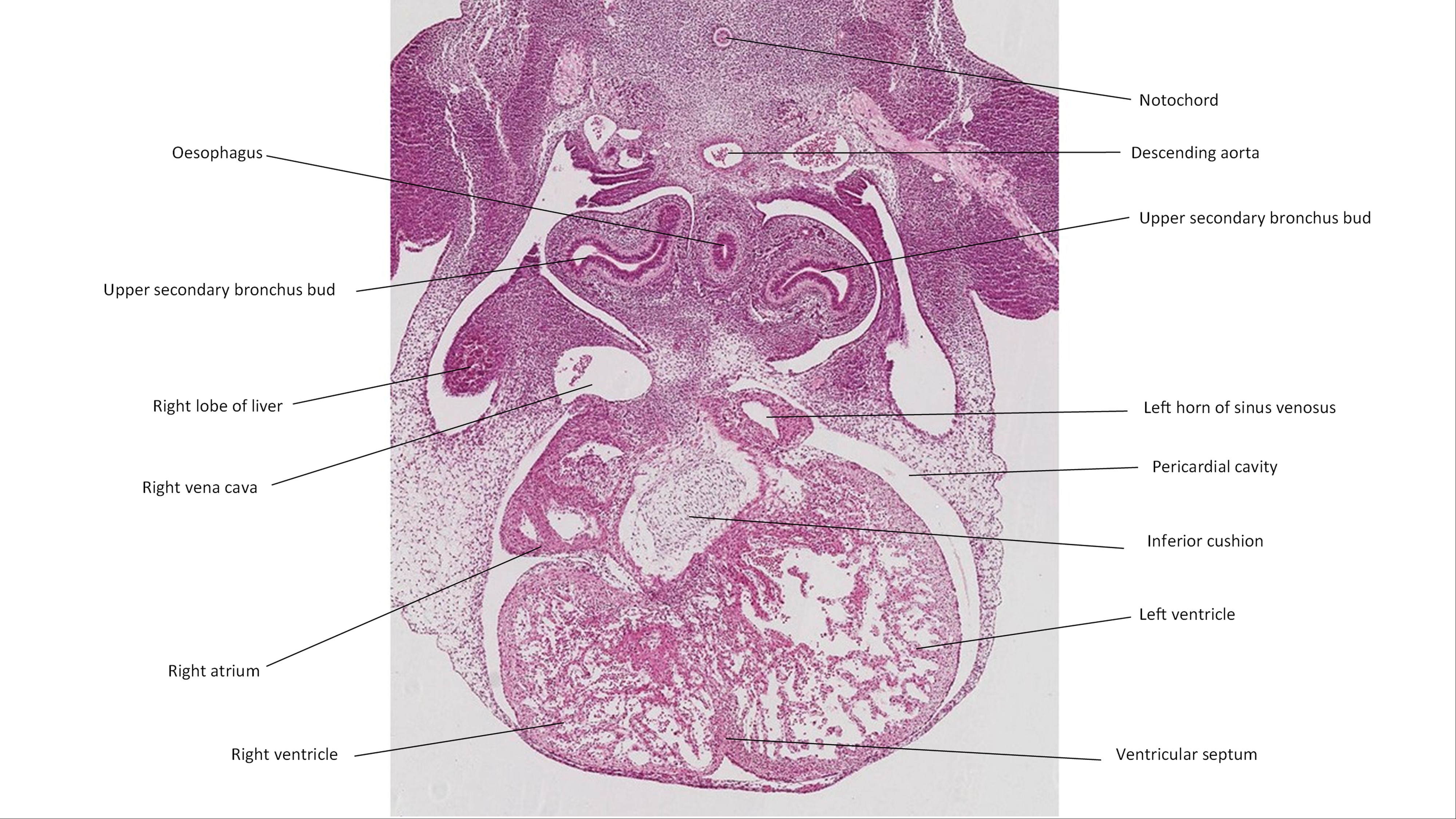 A histology section of a human embryo