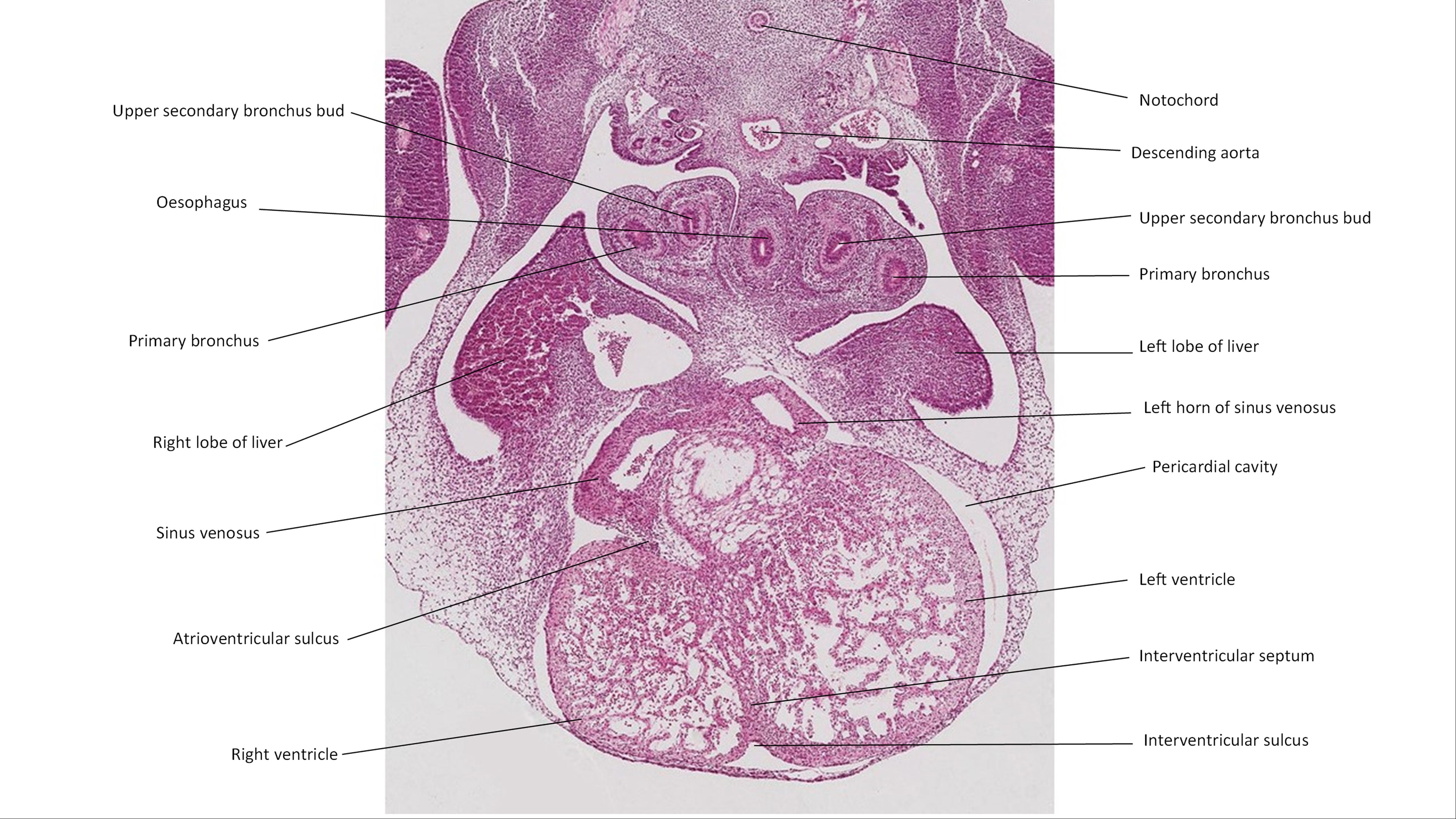 A histology section of a human embryo