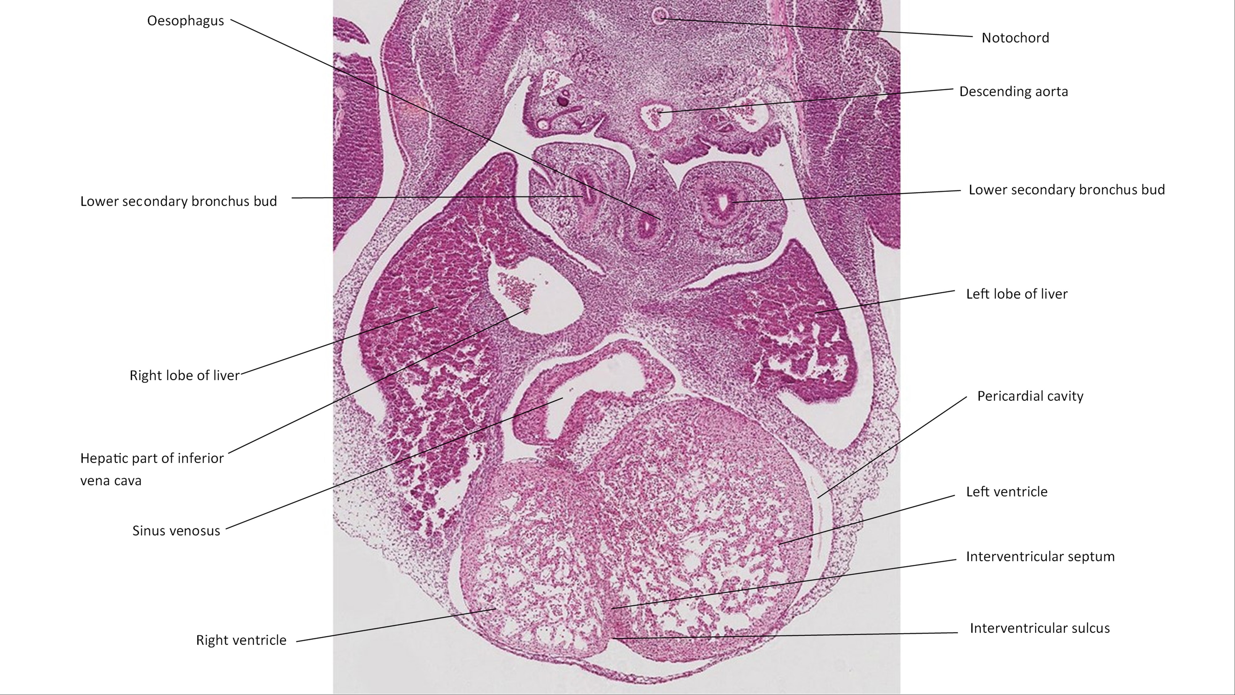 A histology section of a human embryo