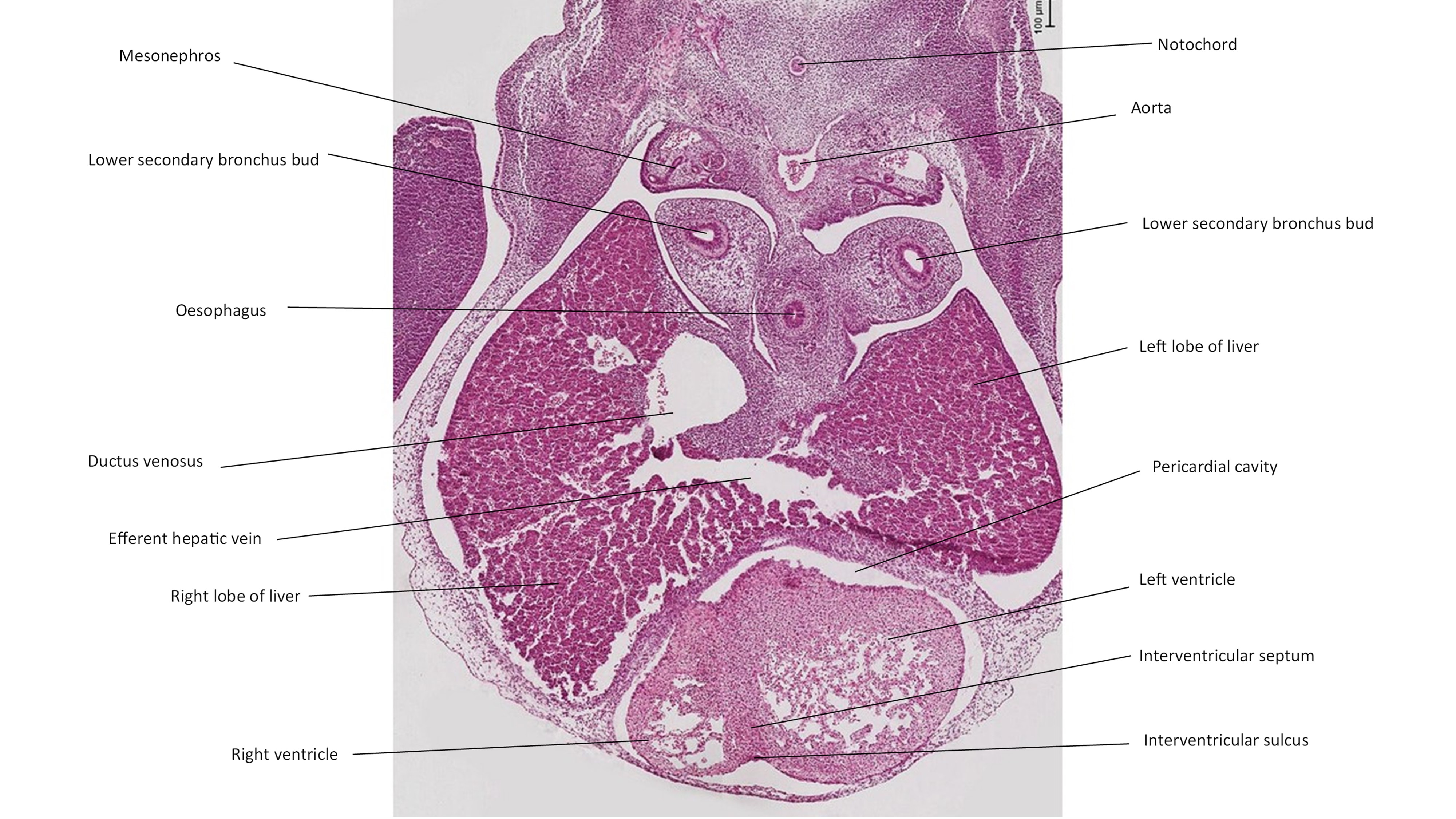 A histology section of a human embryo