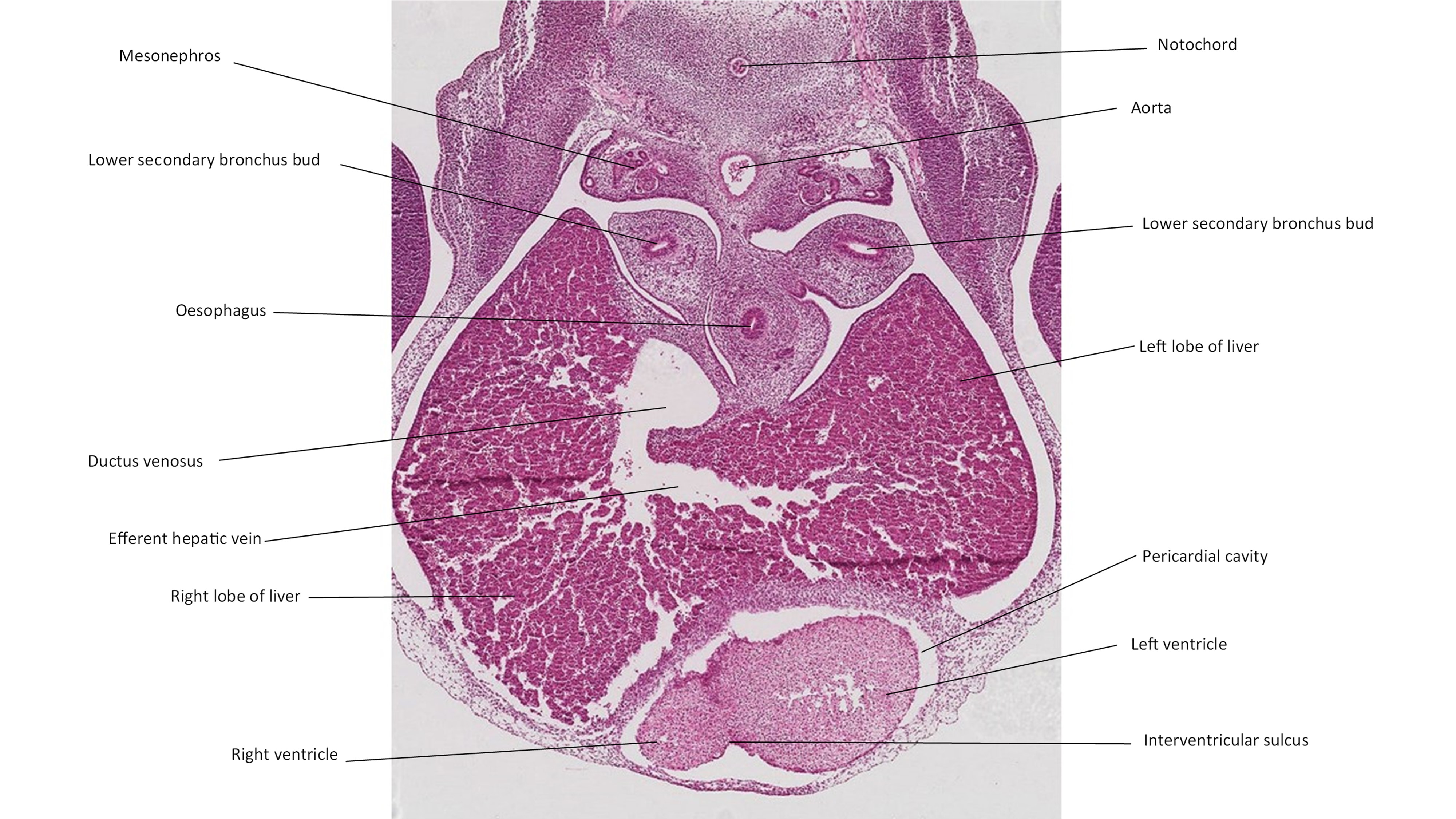 A histology section of a human embryo