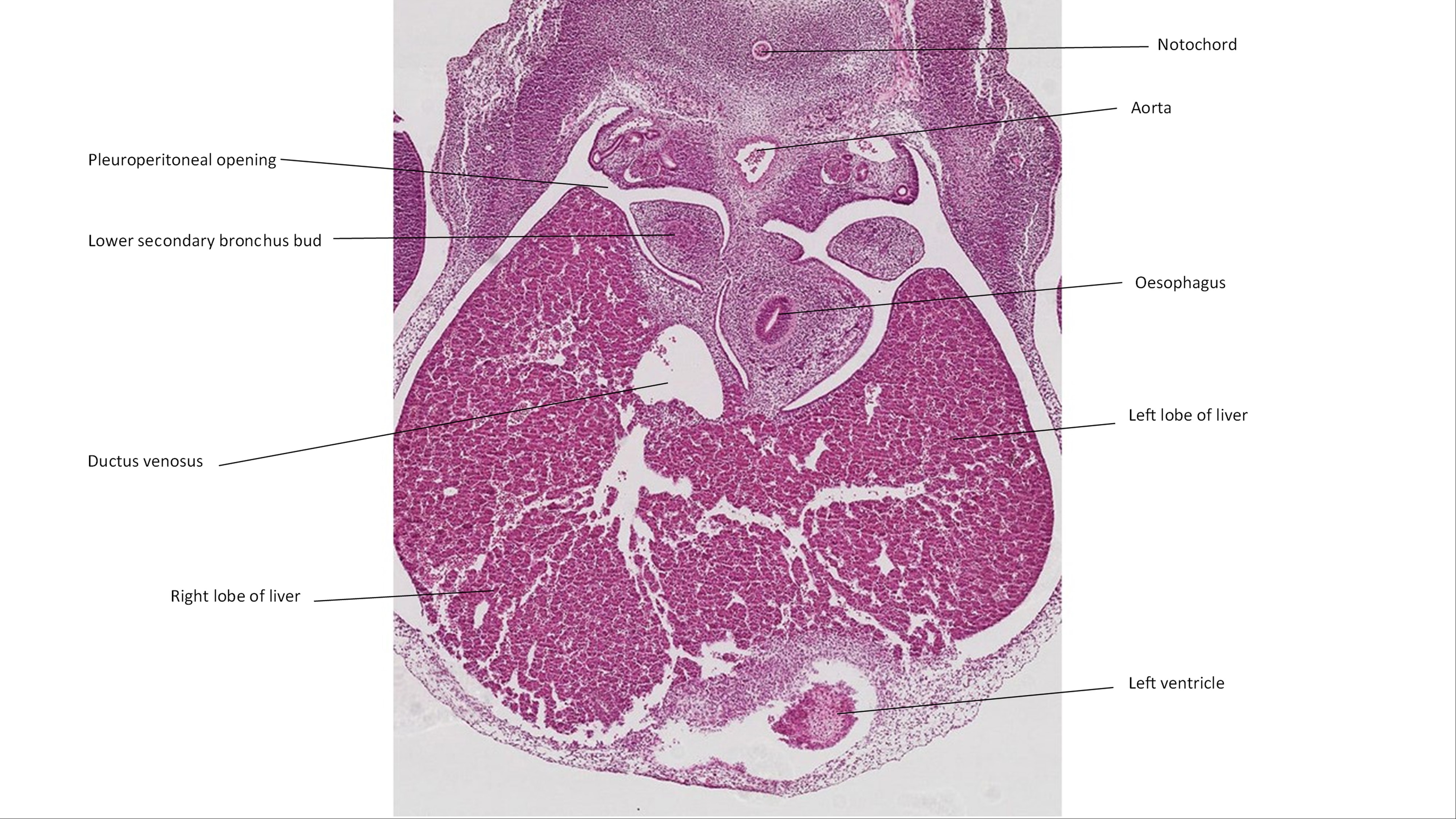 A histology section of a human embryo