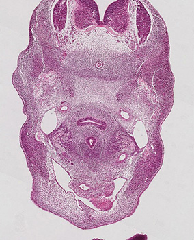 A histology section of a human embryo