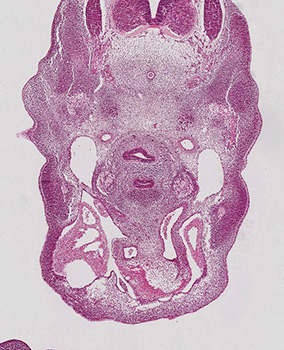A histology section of a human embryo