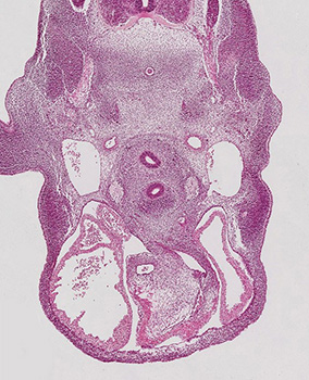 A histology section of a human embryo