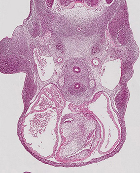 A histology section of a human embryo