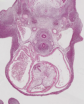 A histology section of a human embryo