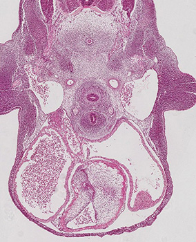 A histology section of a human embryo