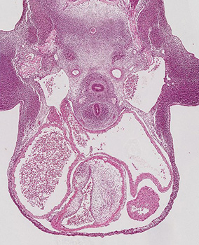 A histology section of a human embryo