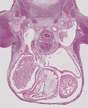 A histology section of a human embryo