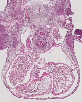 A histology section of a human embryo